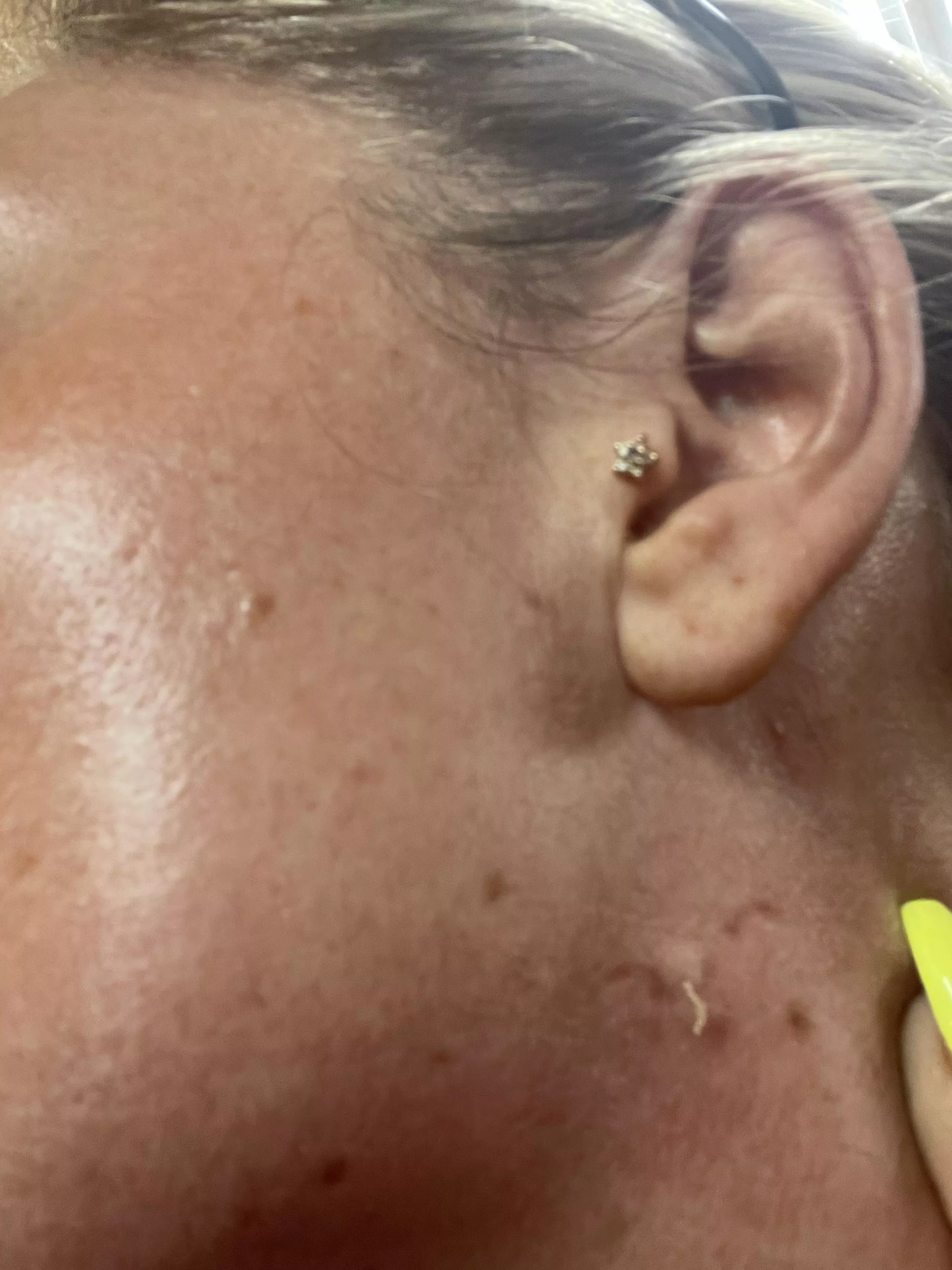 I always get these long ones in my pores below my ears… no my skin was not that dirty it was after a spray tan🤣