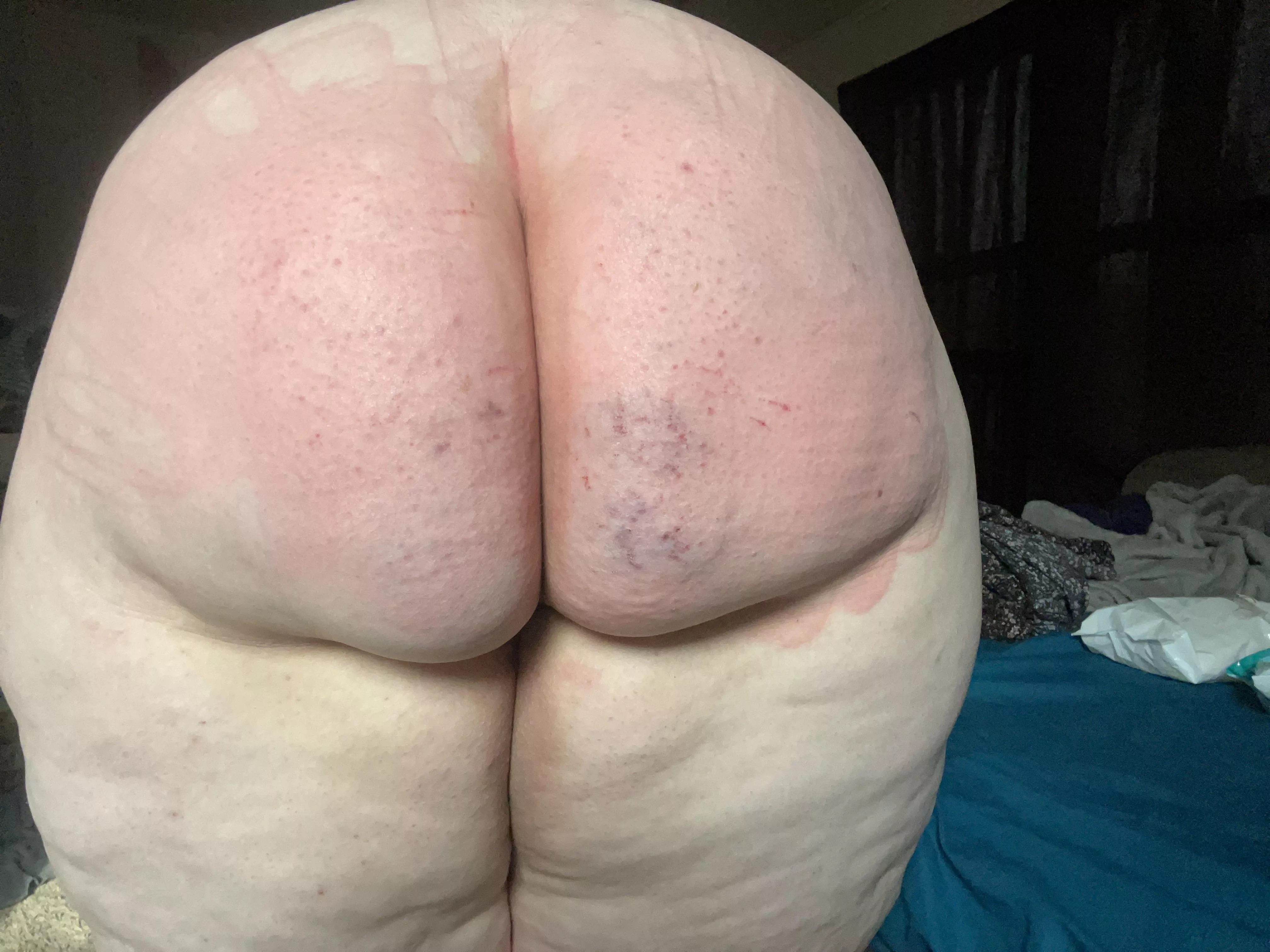 I got the good spankings yesterday. Would you like to see what it looks like today?