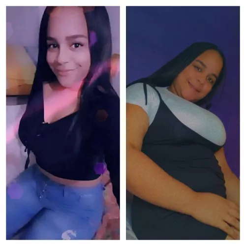 if every more surprised with my before and after I love it, thanks to all the feeders 🙏🏼🤩😍🤩