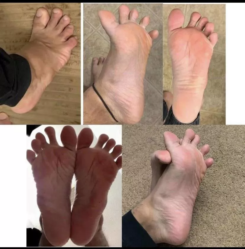 If you live in Connecticut and want to play with my feet hmu and i’lo let you without asking for anything in return If you live in Connecticut and want to play with my feet hmu and i’lo let you without asking for anything in return
