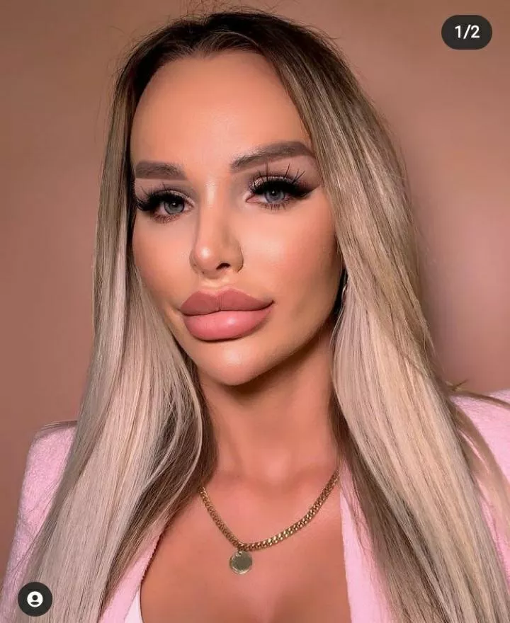 ig uteyka