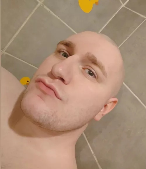 Just embracing the handsome baldness now 😉