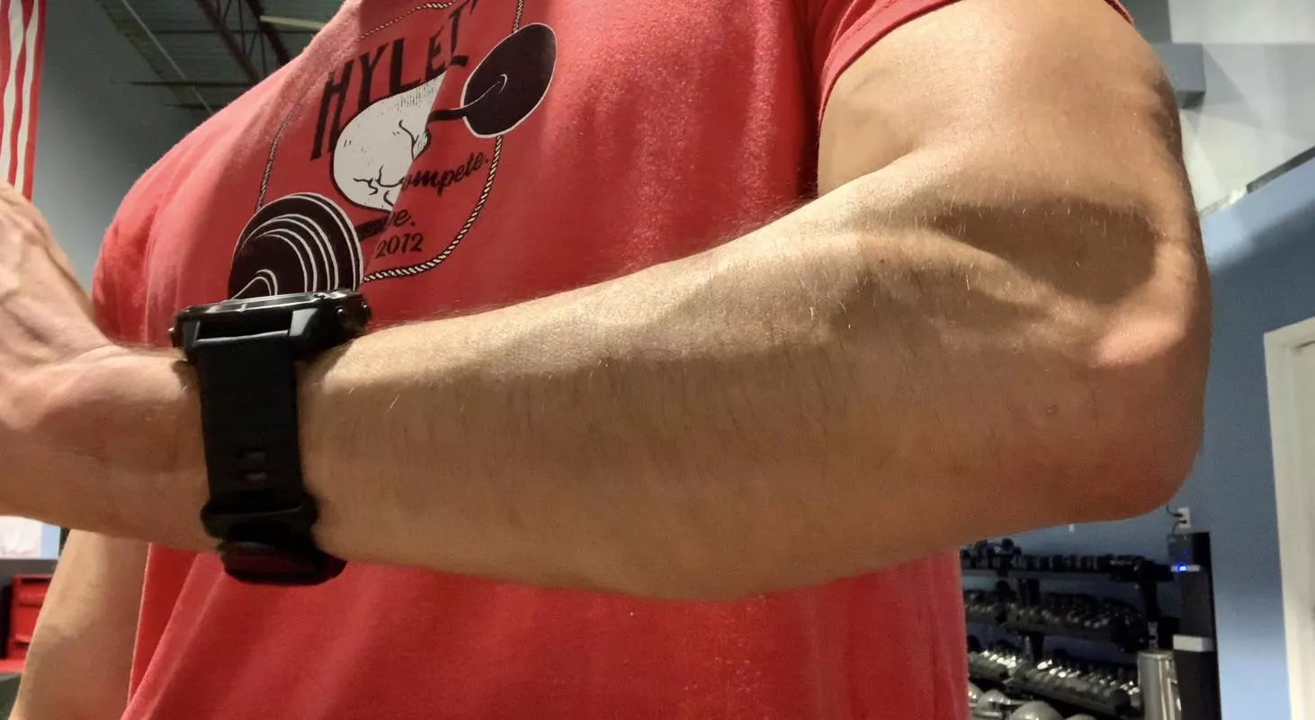 L forearm