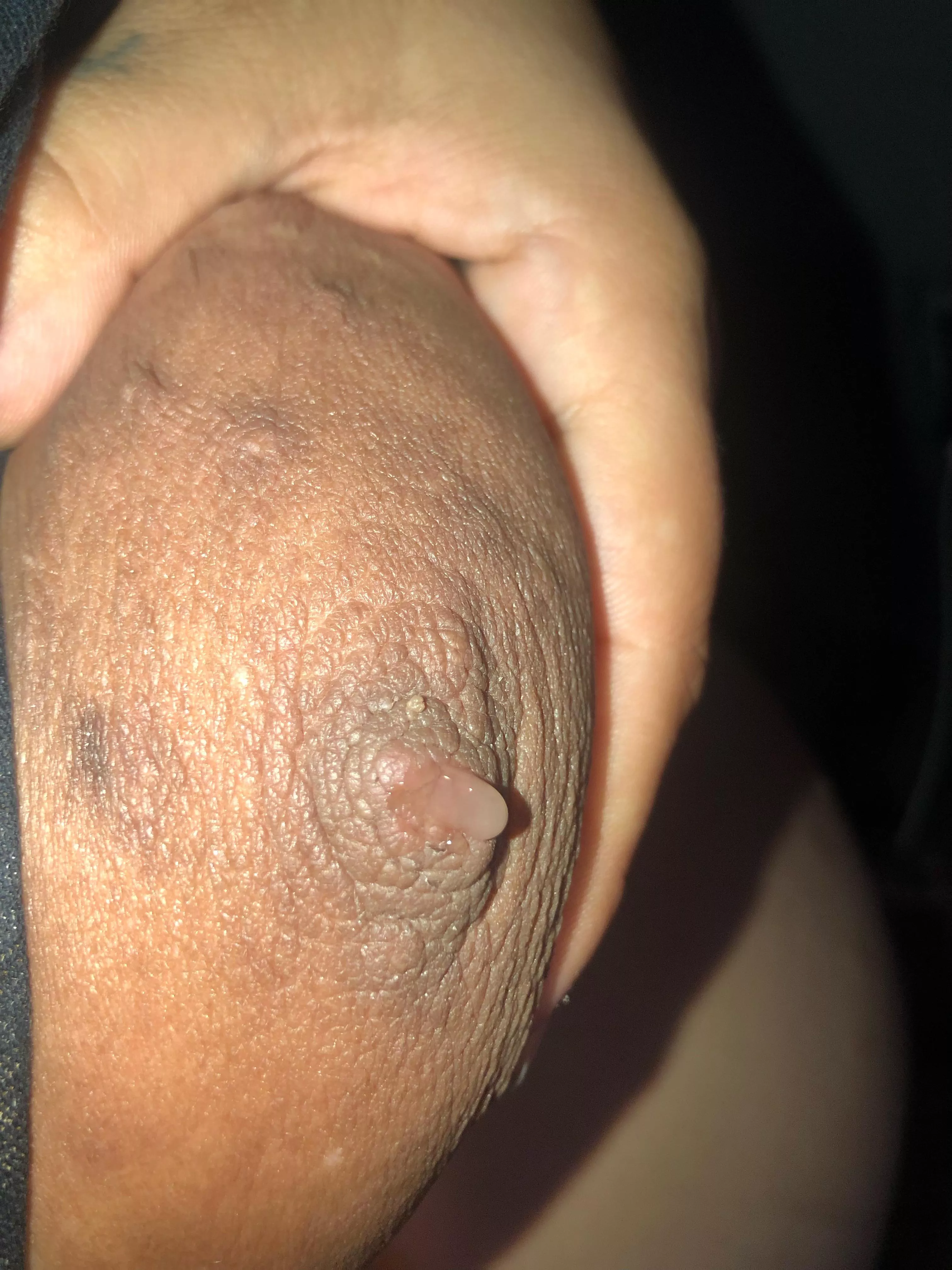 Leaking at 19w😩
