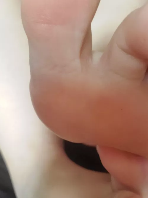 Let me put them on your face 😌