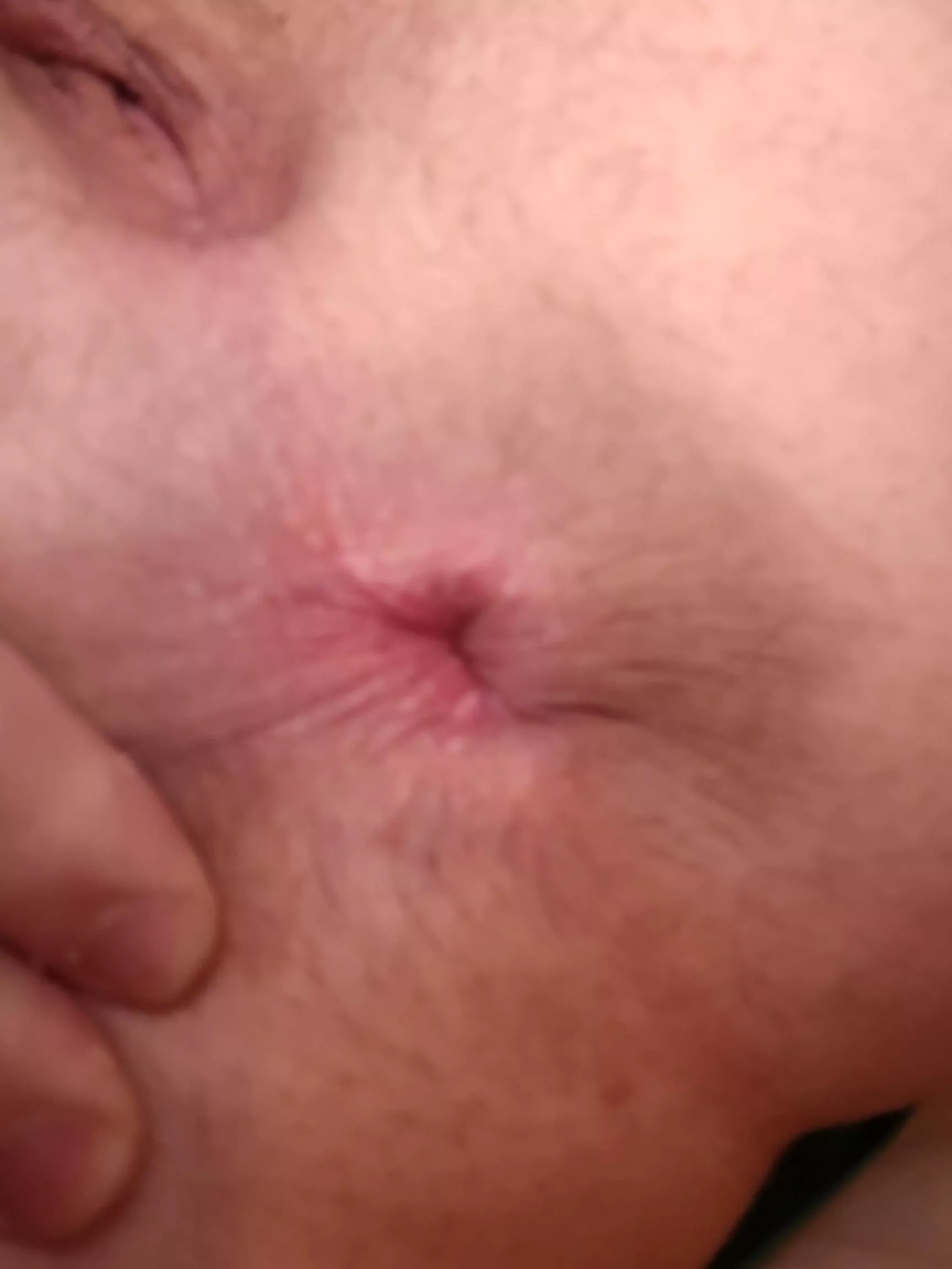 little pink hole
