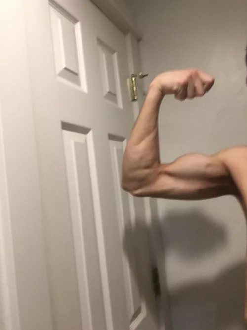 Lol. My shadow looks like a horse hoof