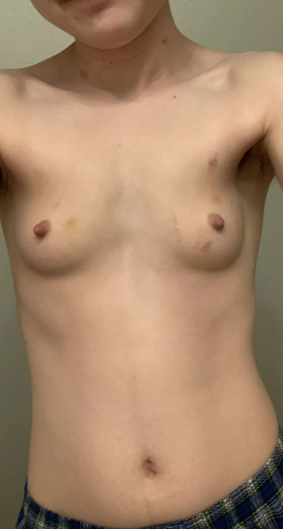 lots of hickies
