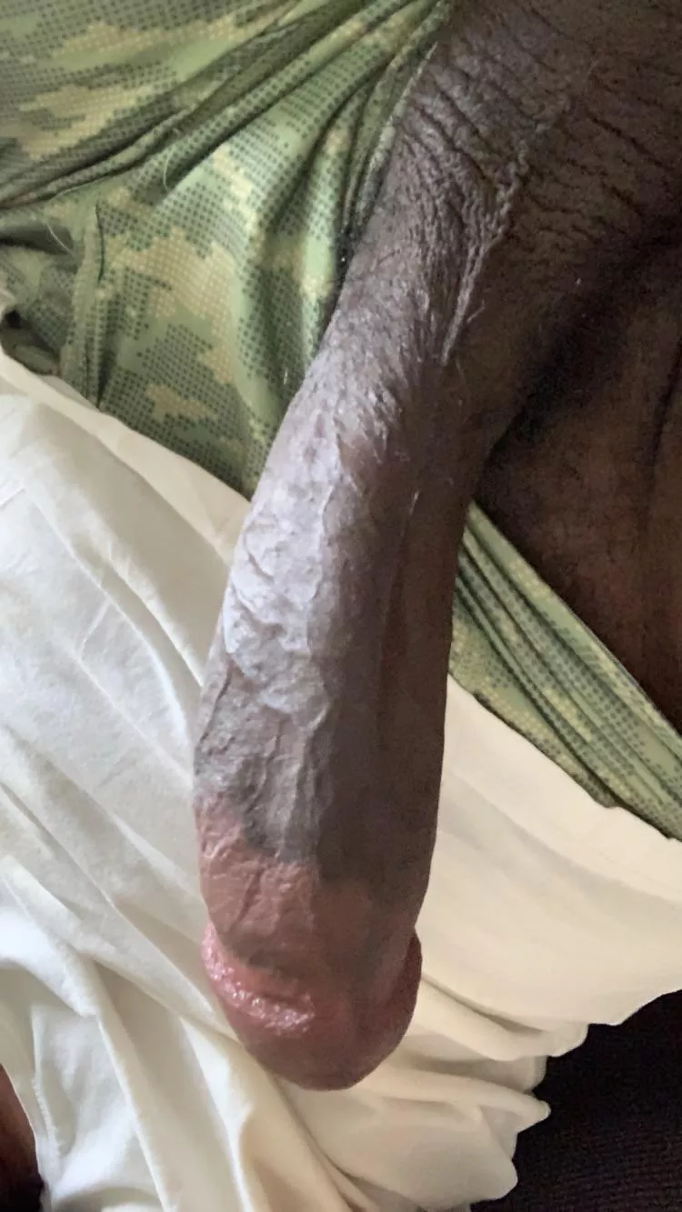 [m] 34, hi