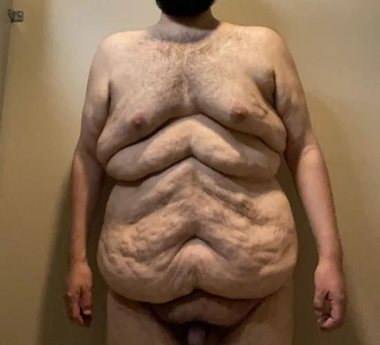 M/26/295 This is my body after losing 125 lbs. I’d choose this body over being +400 lbs any day. The fat roll between my chest and stomach was caused by stomach gripping for the last 16 years.