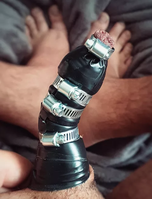 My black tape was reappeared. Now metal clamps have also been placed on my penis. It has become completely unusable. ￼