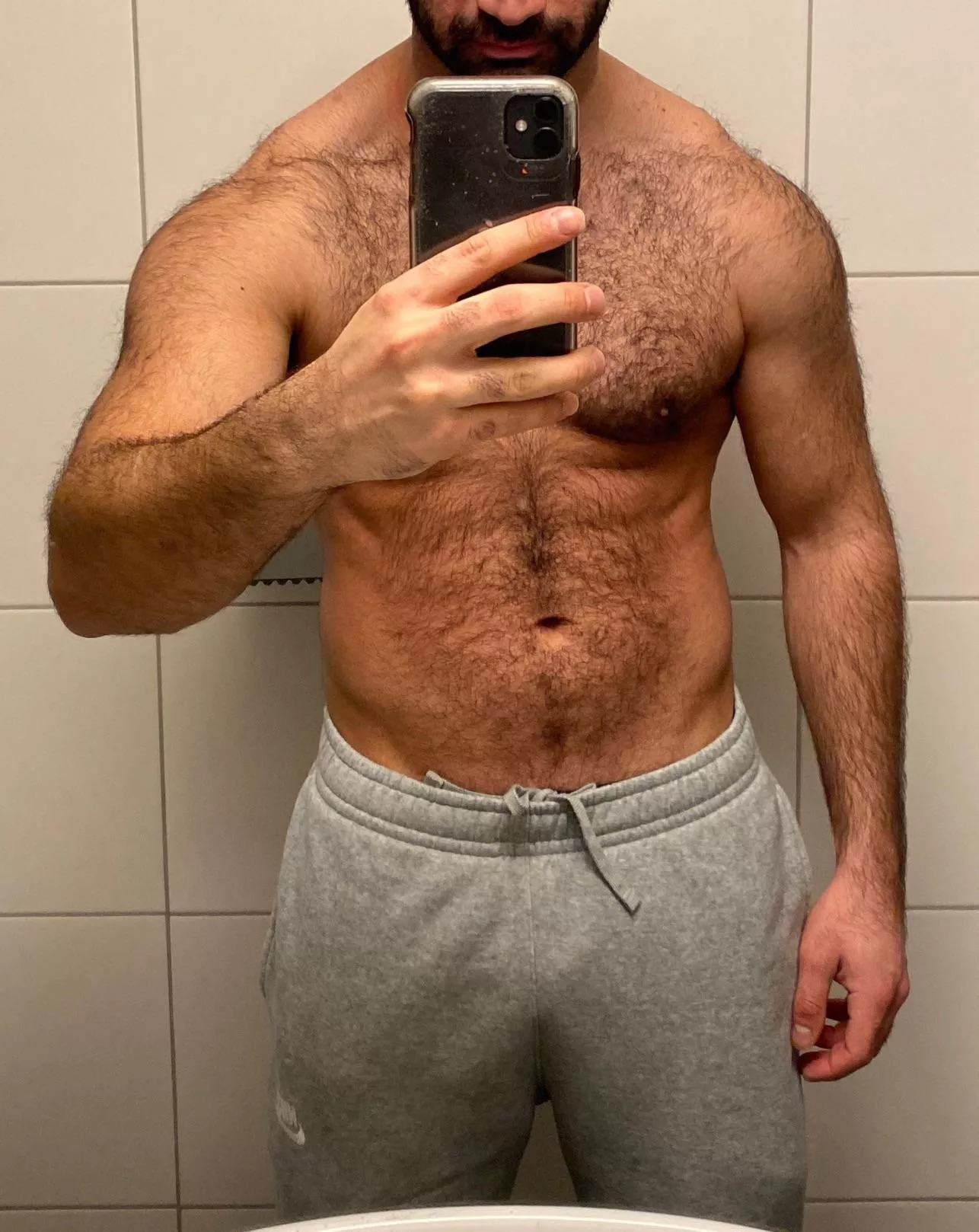 My body