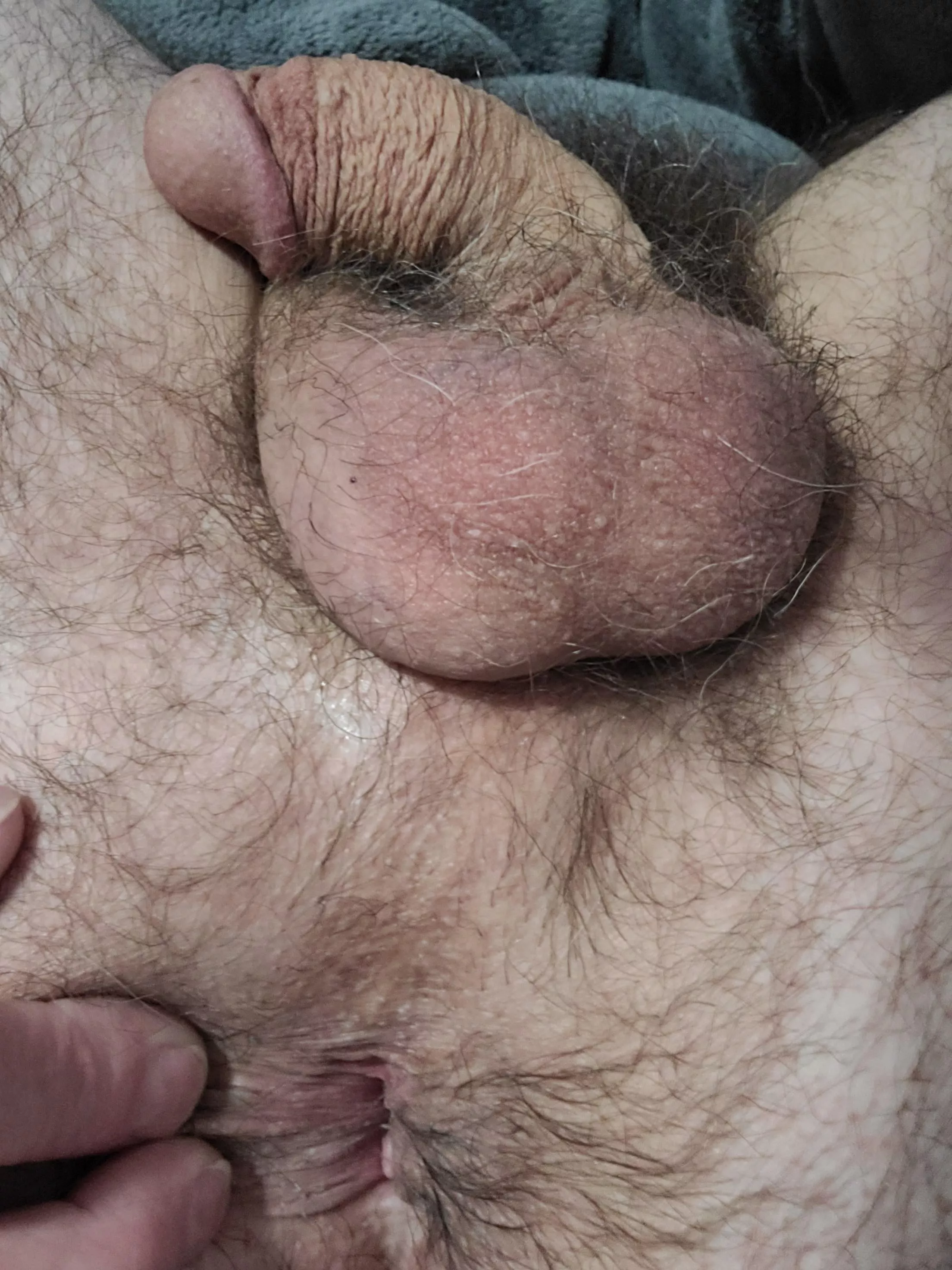 my empty hole