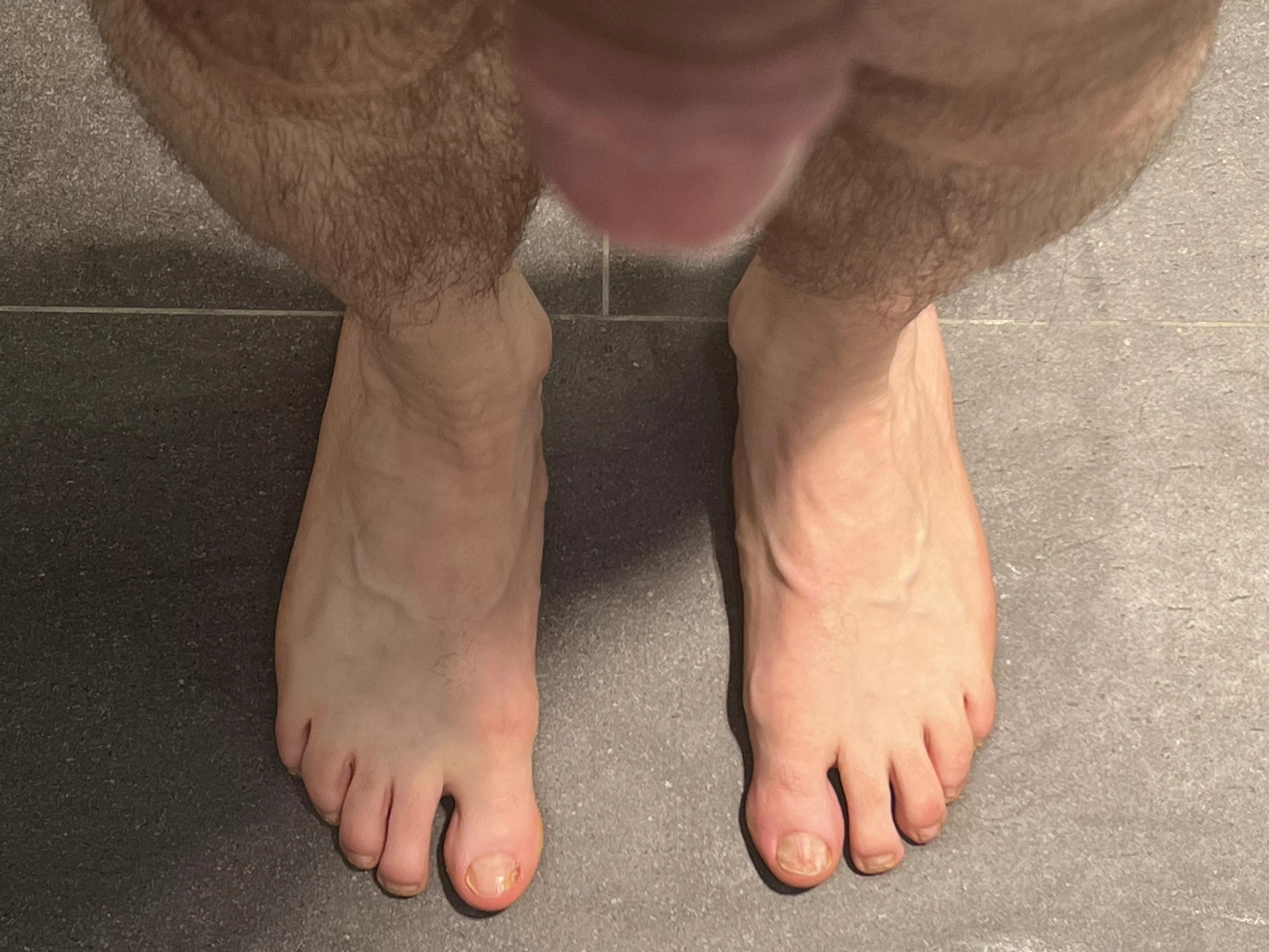 My feet today