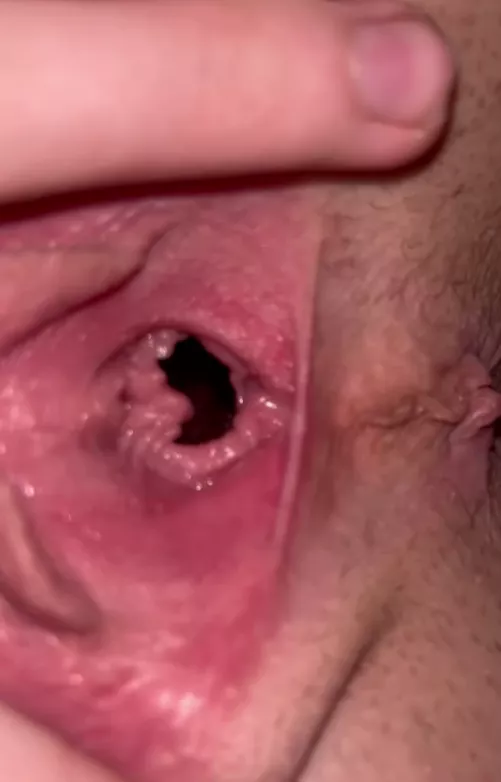 My hole is so stretched out! Do you want me to open it wider for you?