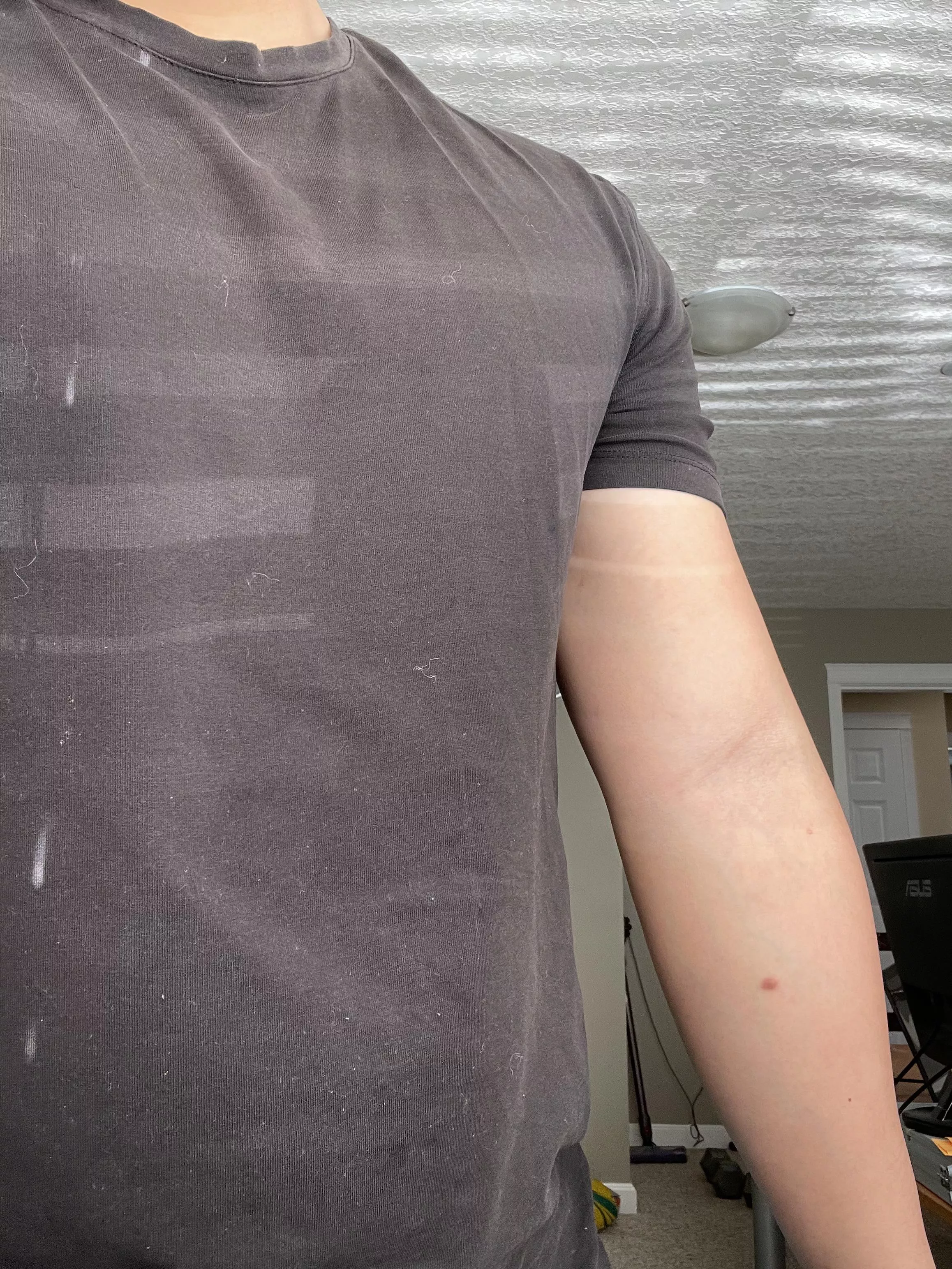 My normal arm