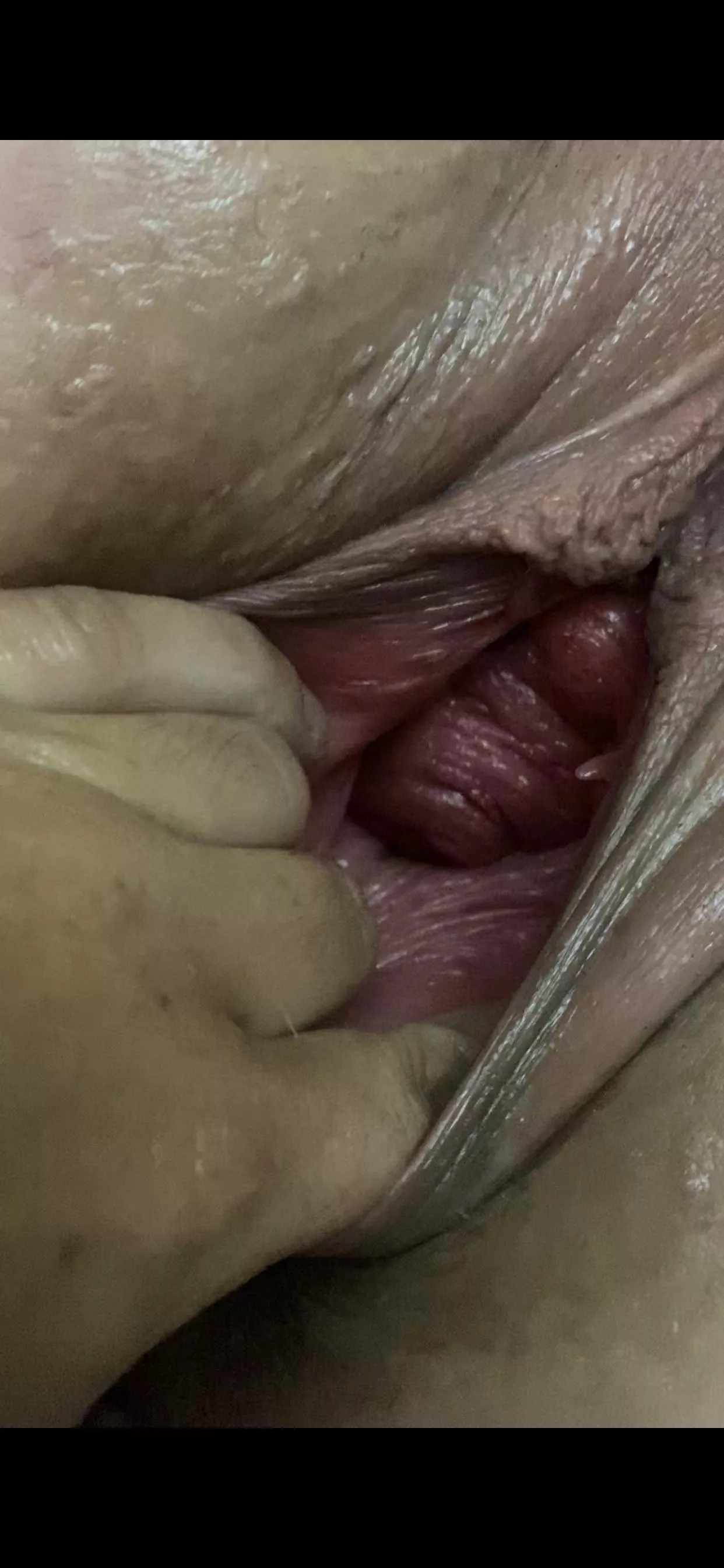 My pussy was really torn open after this My pussy was really torn open after this