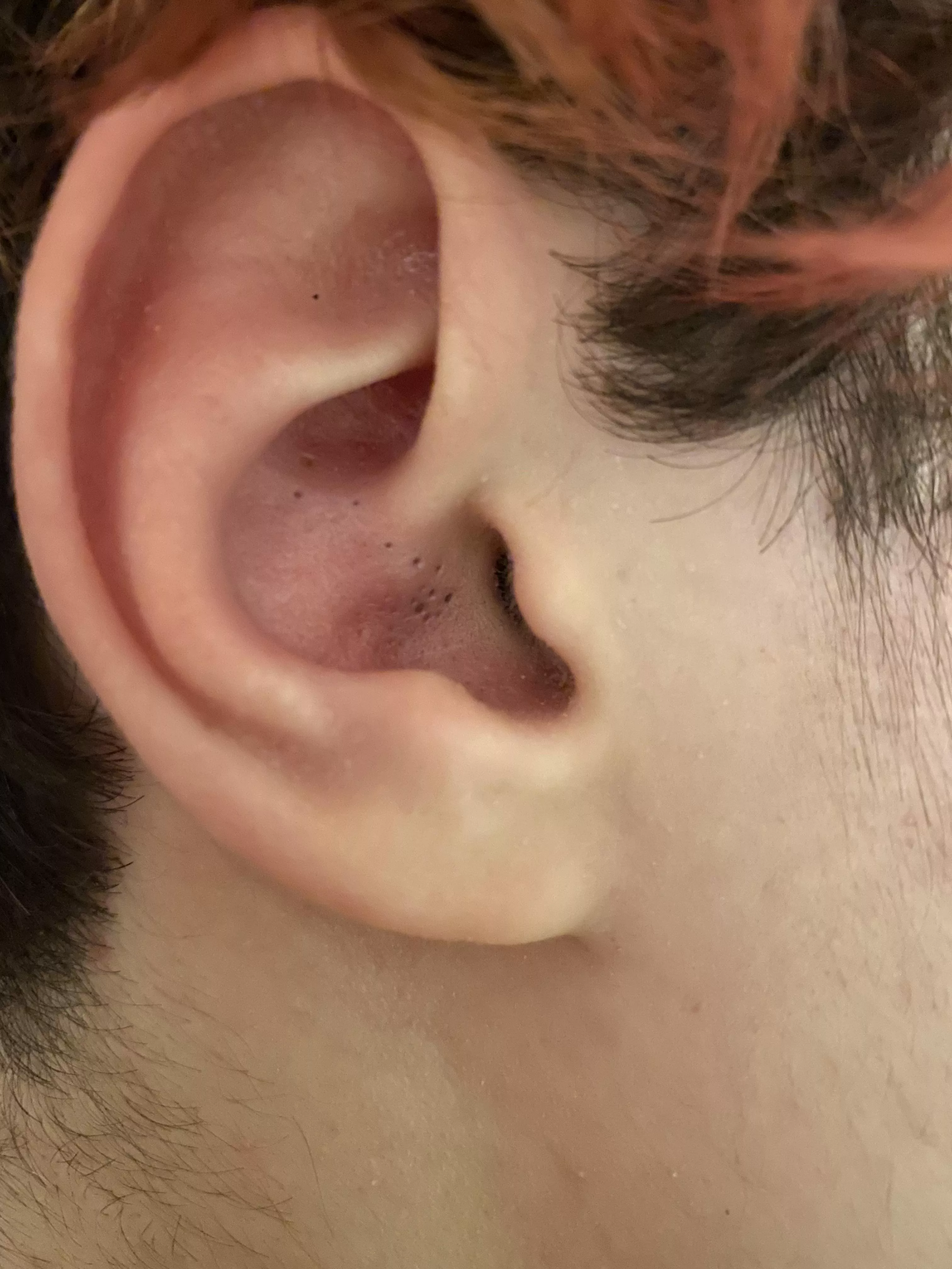My teenager won’t let me touch his ear. These are taunting me!