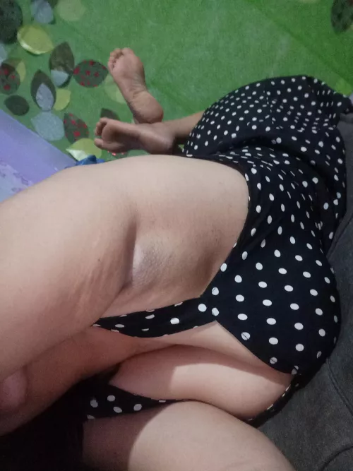 no hair since birth...