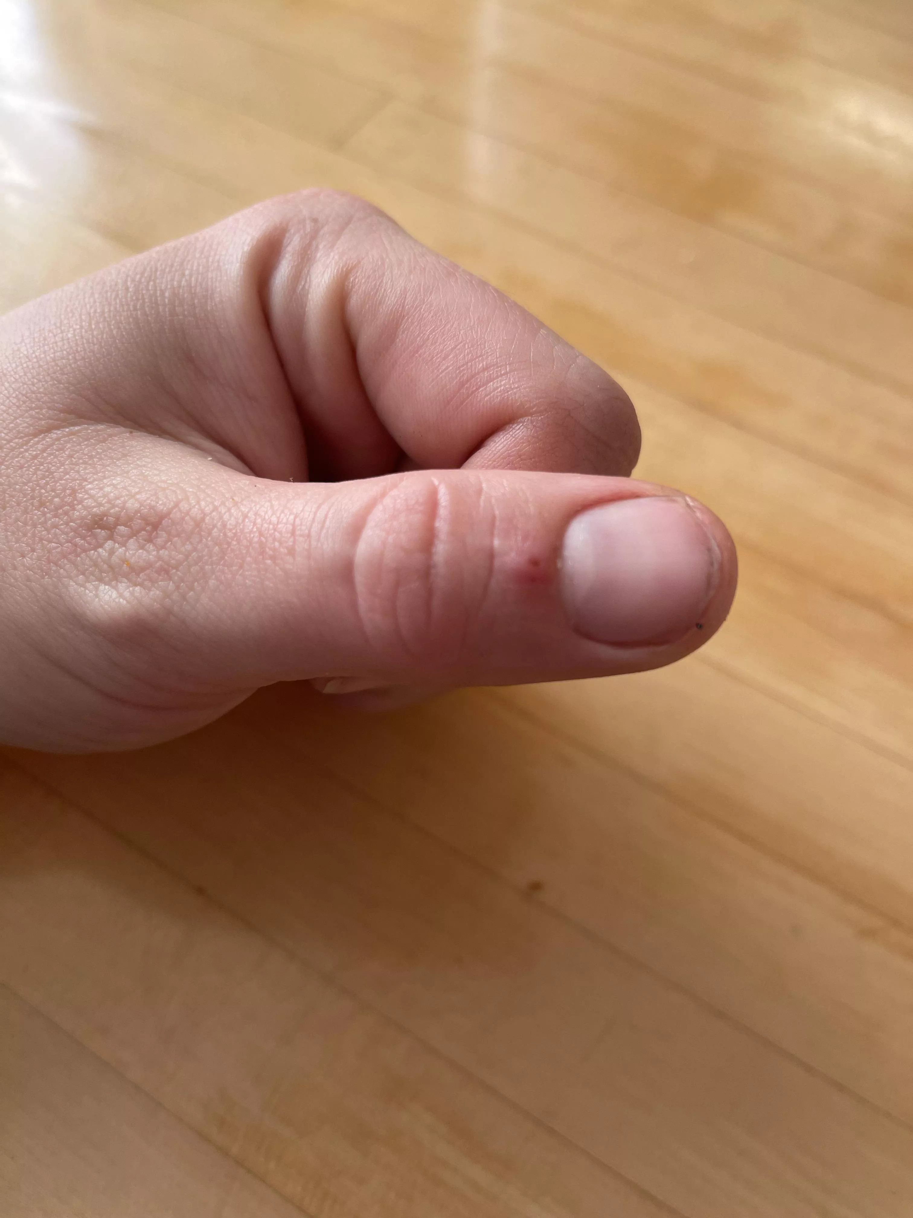 Not sure what’s going on here. Assuming there’s a splinter. Nothing happens when I squeeze. Any advice to prime this thing to score some sick popping footage? Not sure what’s going on here. Assuming there’s a splinter. Nothing happens when I squeeze. Any advice to prime this thing to score some sick popping footage?