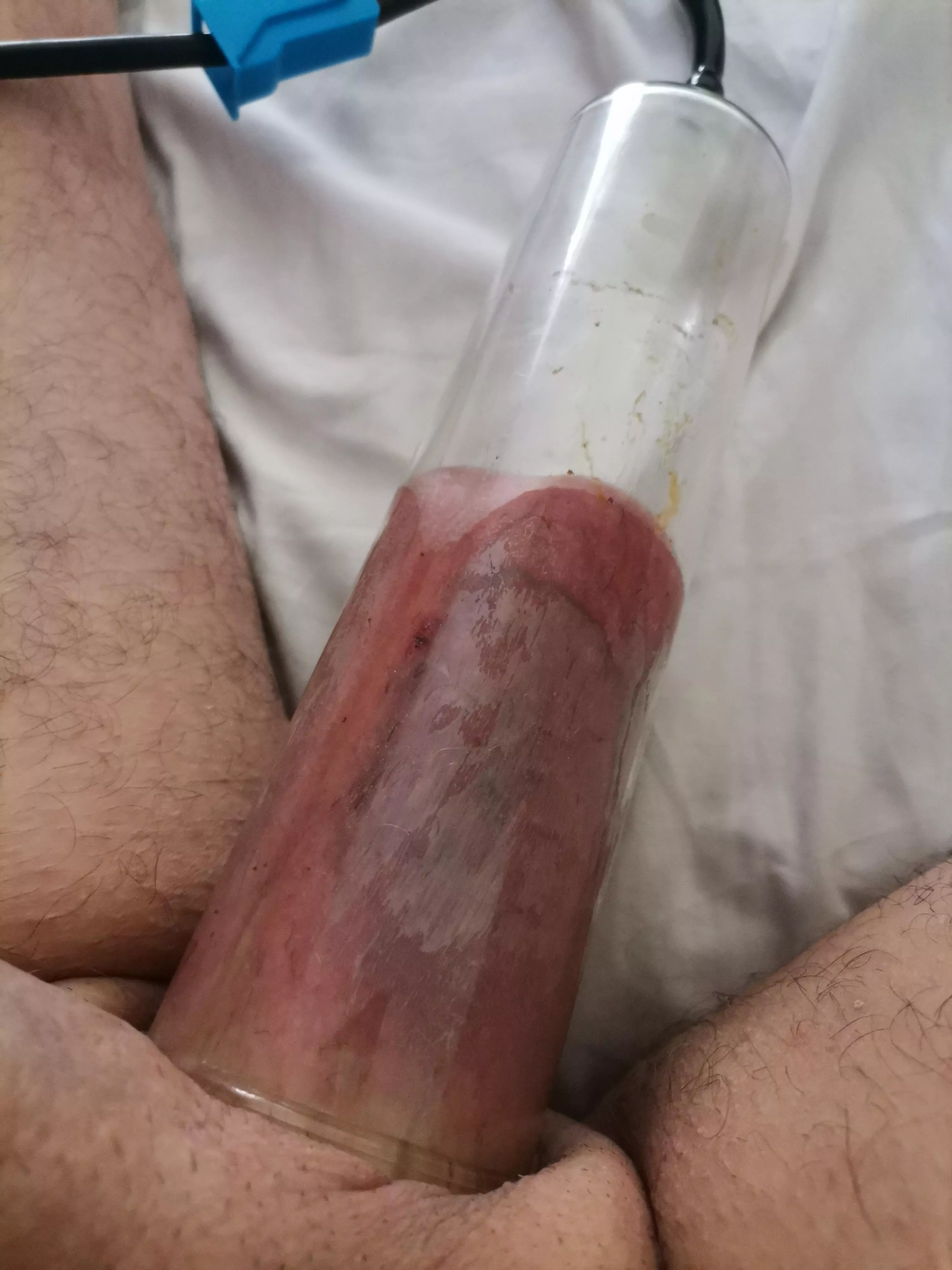 Nut sack pump