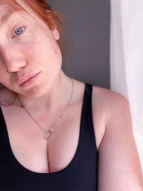 One big freckle.