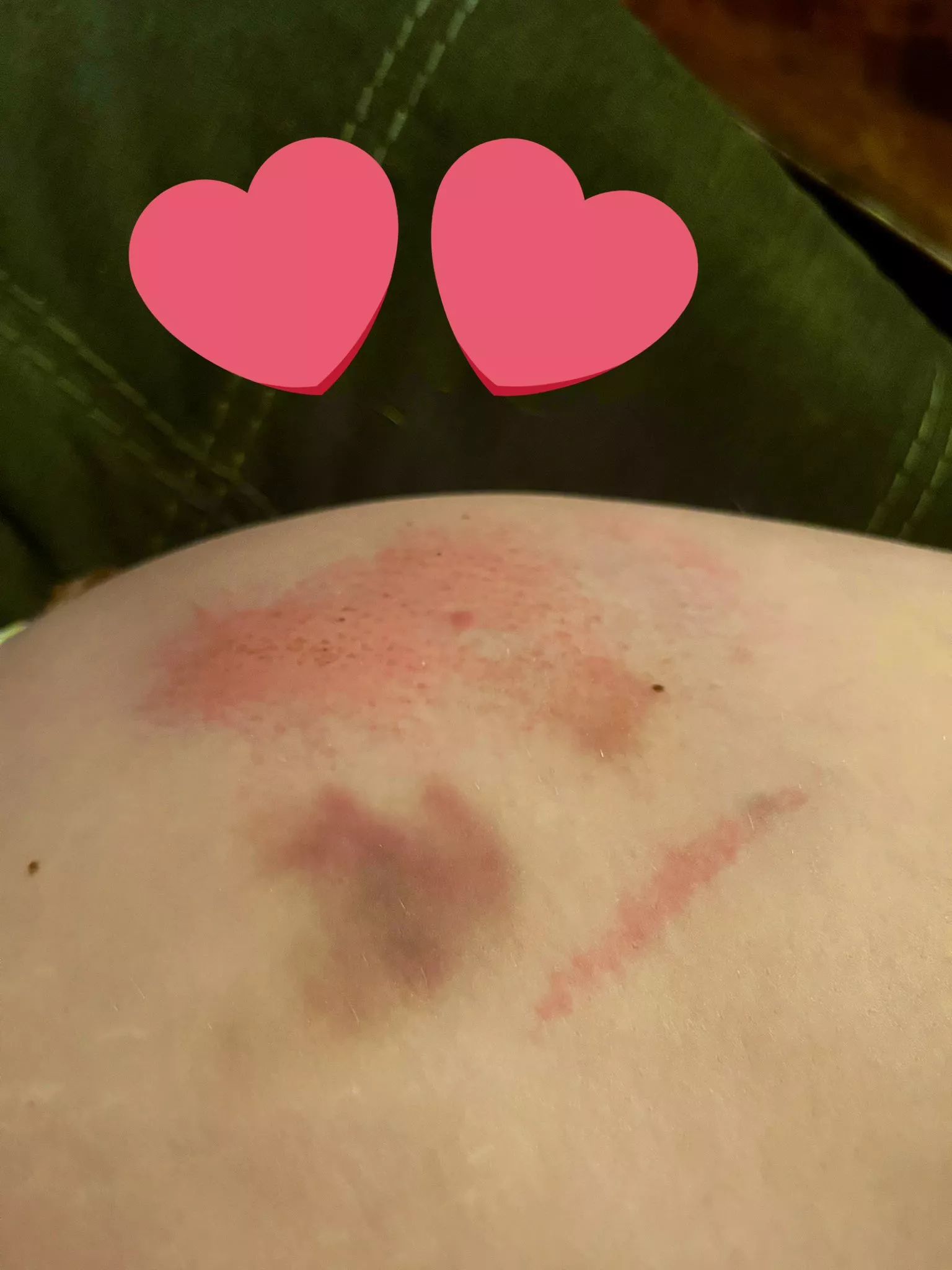 ouchie