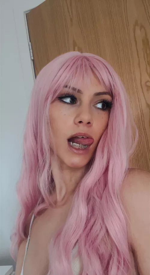 Pink hair + braces 🤓