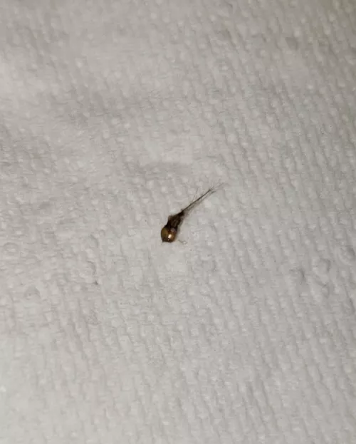 Popped this little bugger out of my side. So many little hairs coming out of it