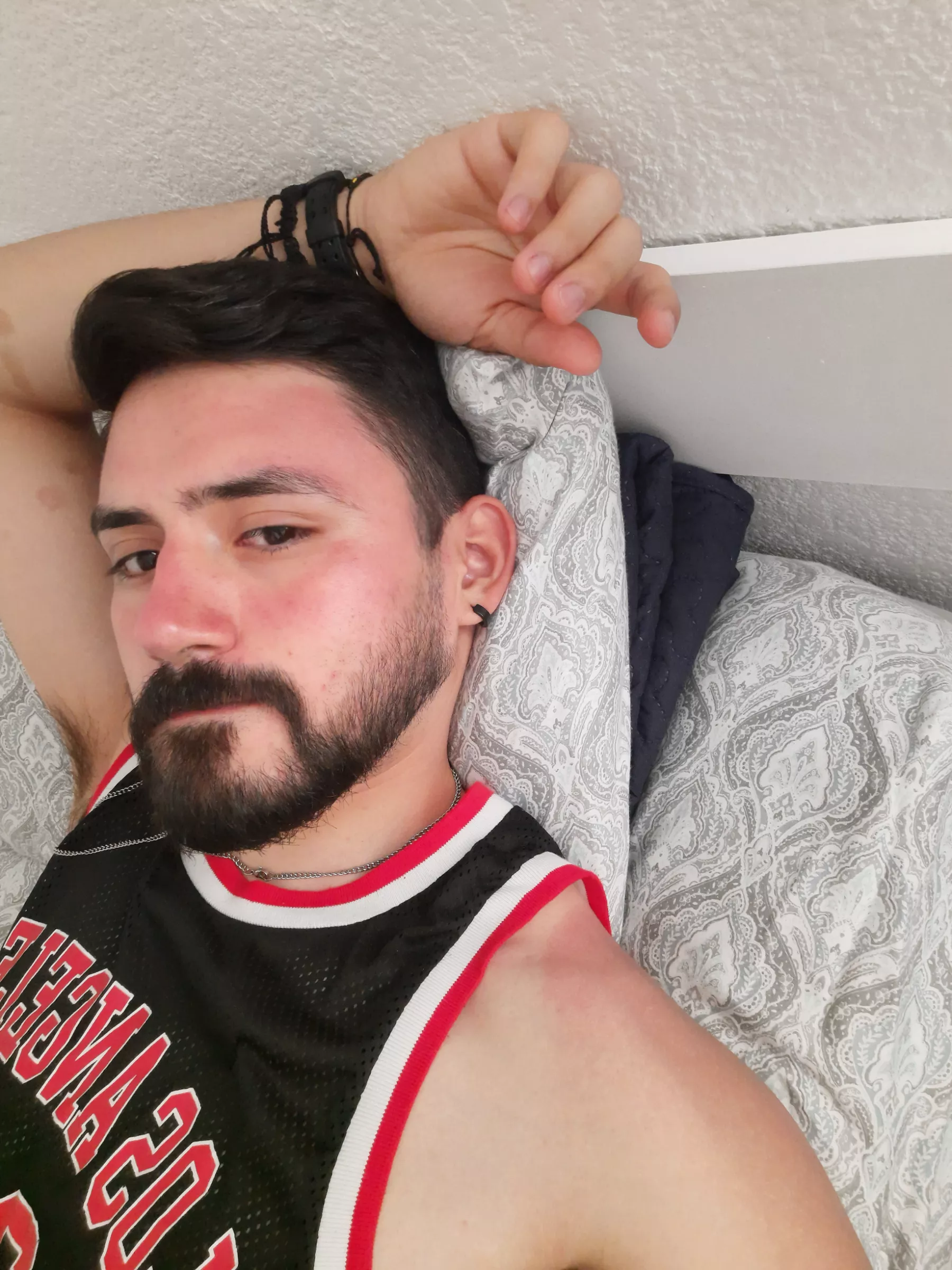 Post edc sunburn