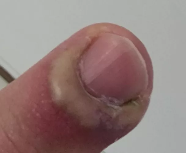 Prime for popping...