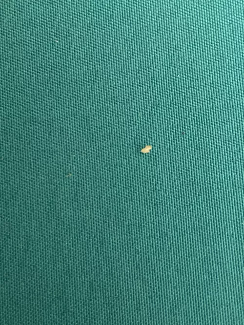 Pulled this gem out of my face after a shower