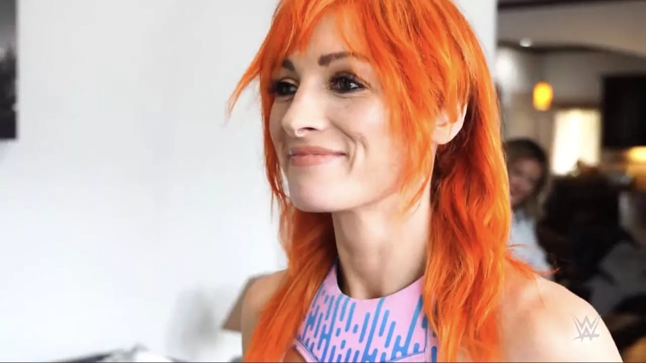 So Hot 🧡😍