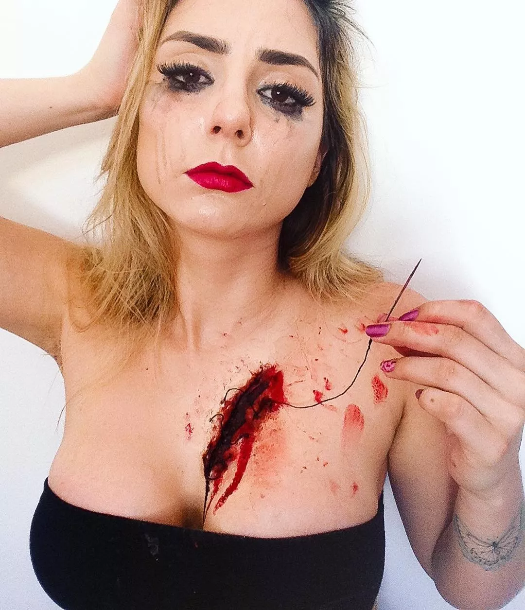 stitches