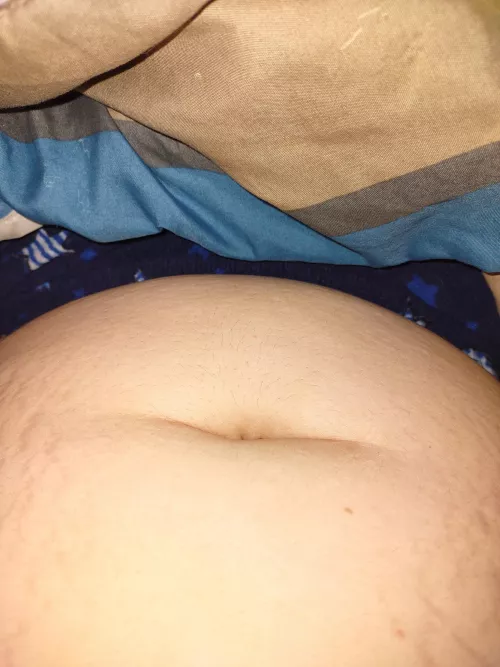 stretch marks and belly button
