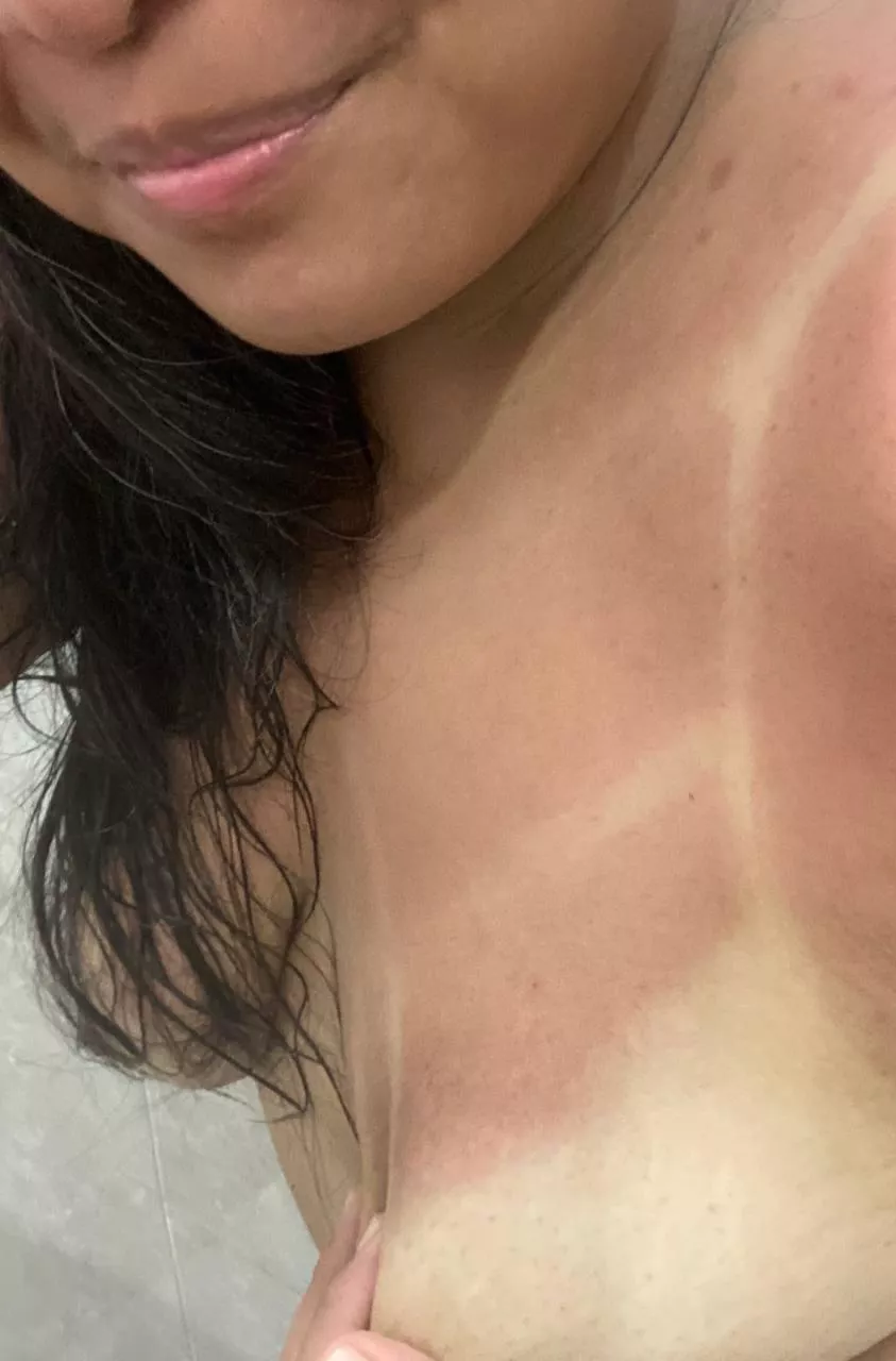 summer [f]eels. need a volunteer to put some aloe on me? 🥵