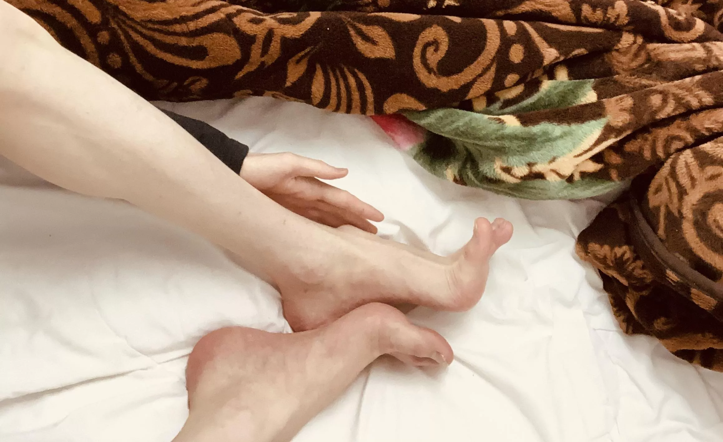 Sweaty feet