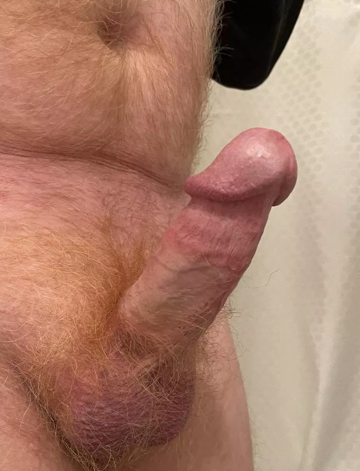 Swollen head