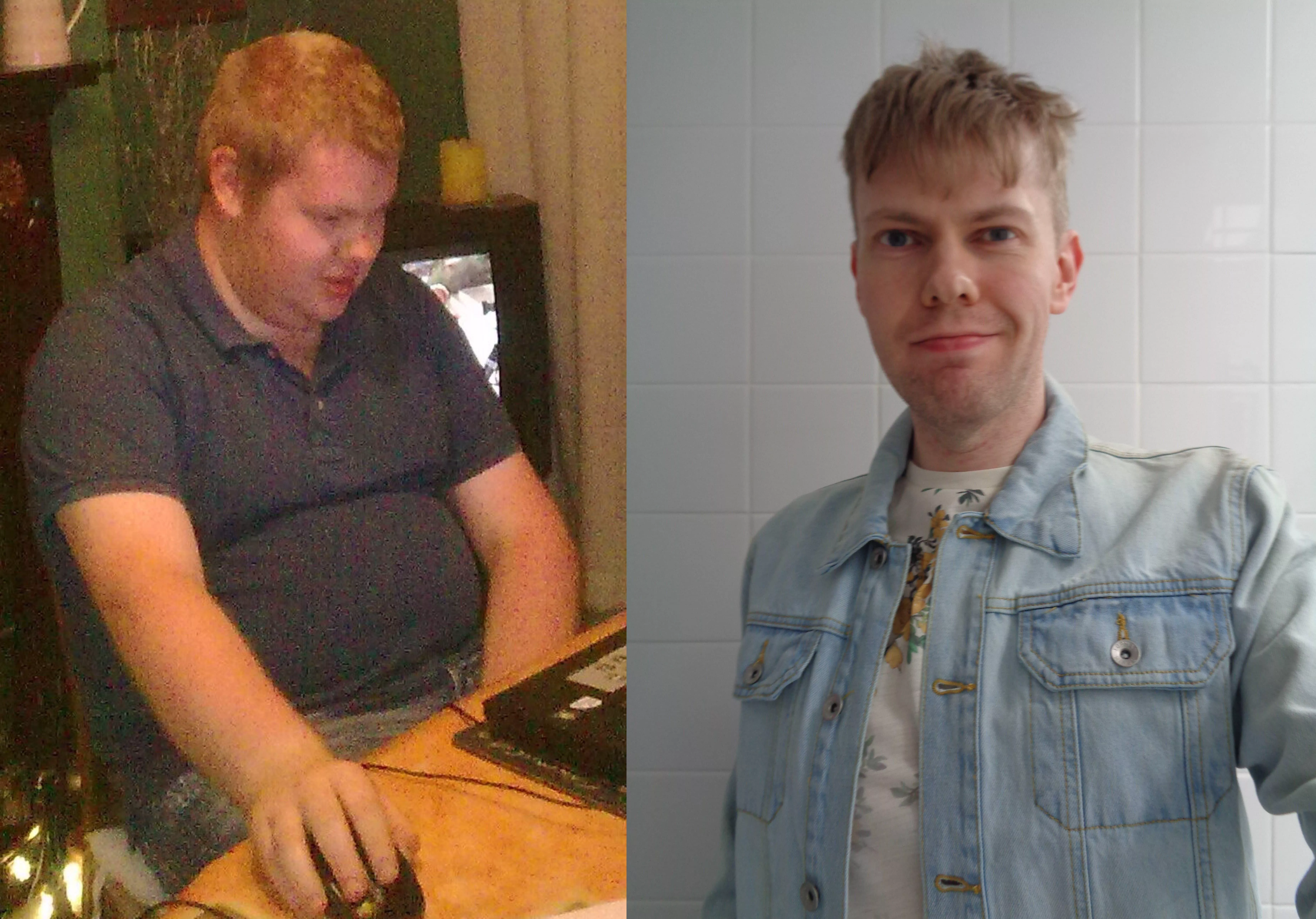 Ten-year glow up: 24 vs. 34! To any gaymers who are struggling with their weight, it really can be done with patience, time and effort, please trust me! :) Ten-year glow up: 24 vs. 34! To any gaymers who are struggling with their weight, it really can be done with patience, time and effort, please trust me! :)