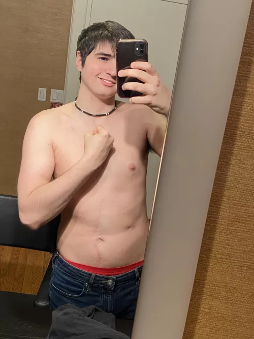 Thank you to all the people who commented on my post yesterday about my missing eye. It really meant a lot. I’m glad this community is so loving. Kind of the opposite you expect from Reddit sometimes.