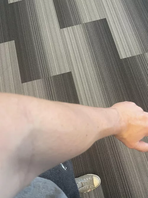 The non dominant arm…