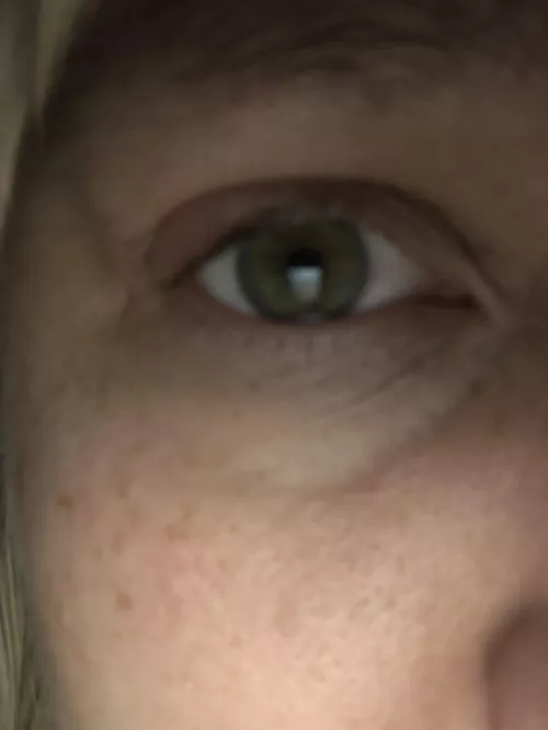 This baby is brewing hard. My eyelid hurts. If it pops you’ll be the first to know!