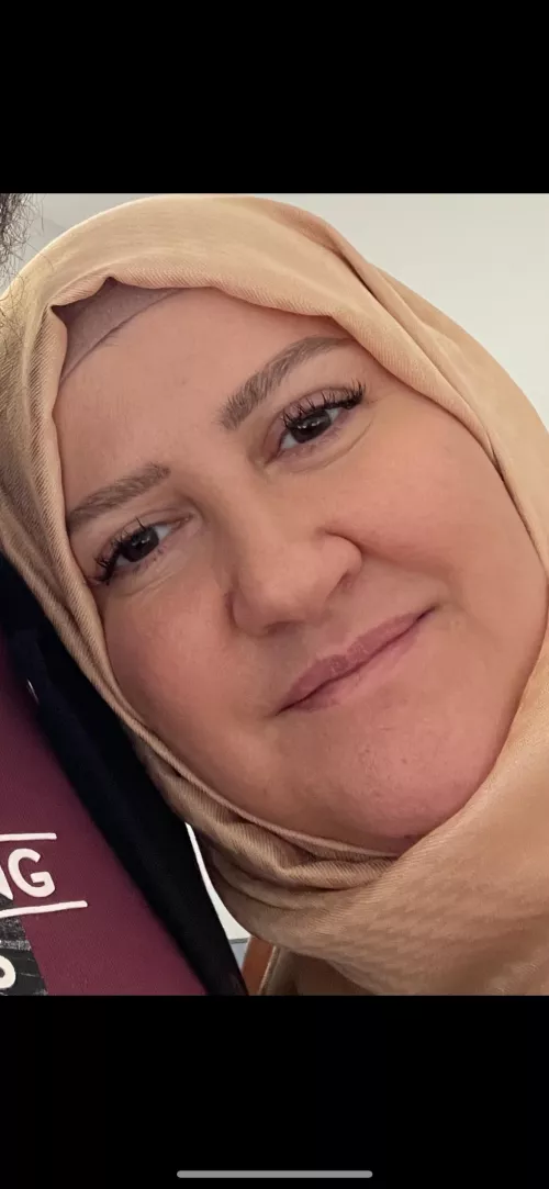 Those who want to tribute to my mother's face, send a message, kik moonsubbb