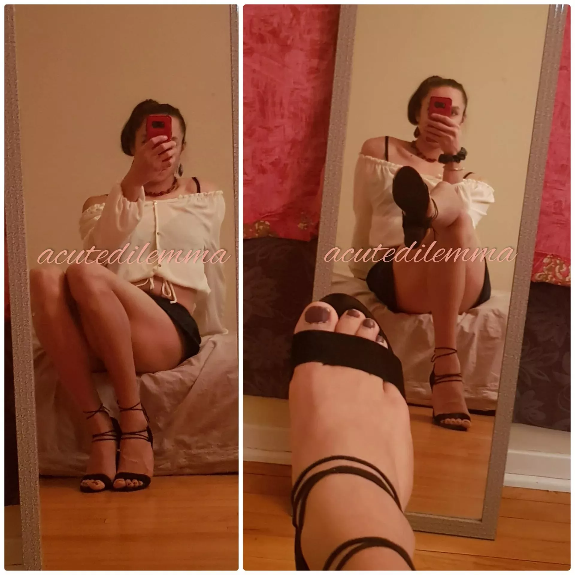 Toes anyone?
