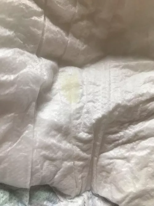 What is this? I found it on the inside of my diaper.