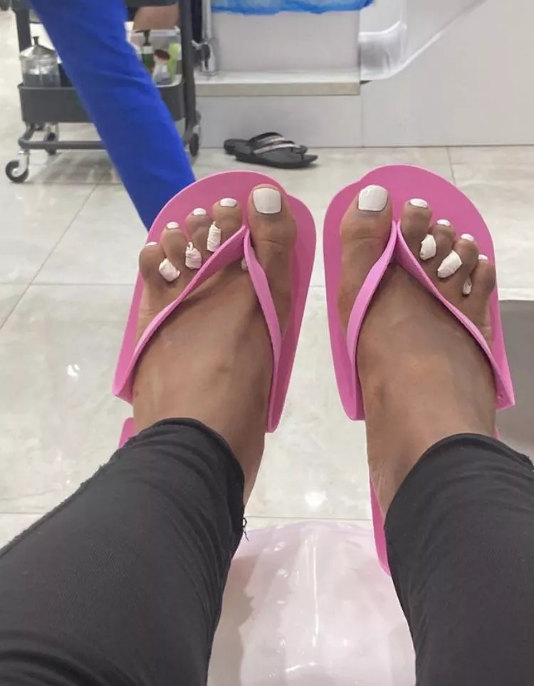 white toes