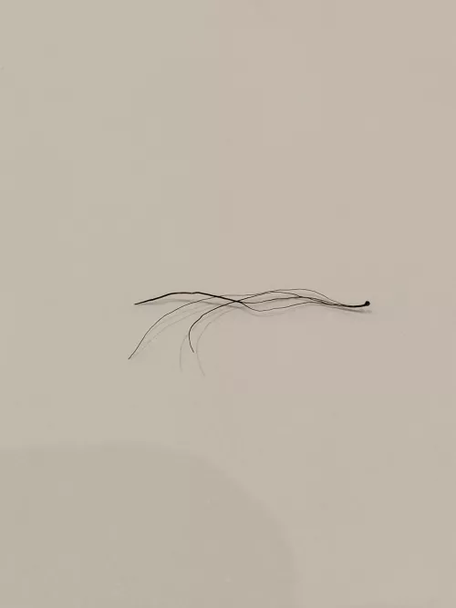 Wife pulled out a weird hair.