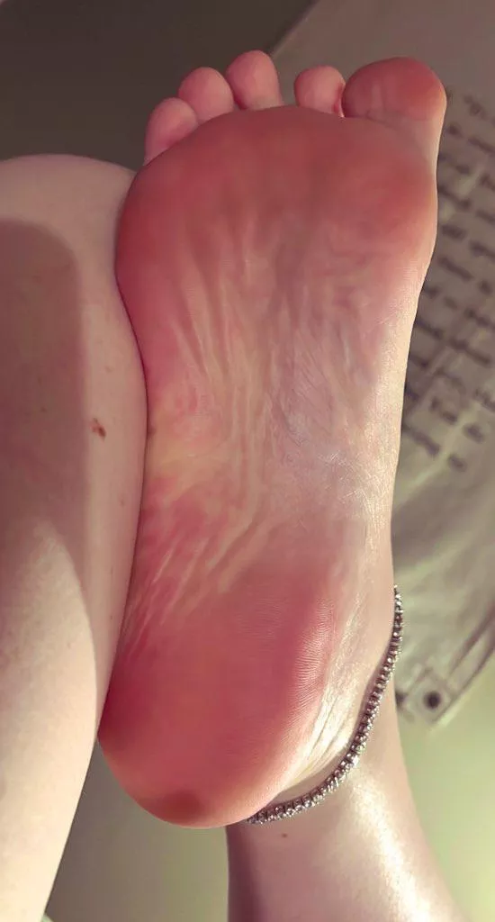 Wrinkle