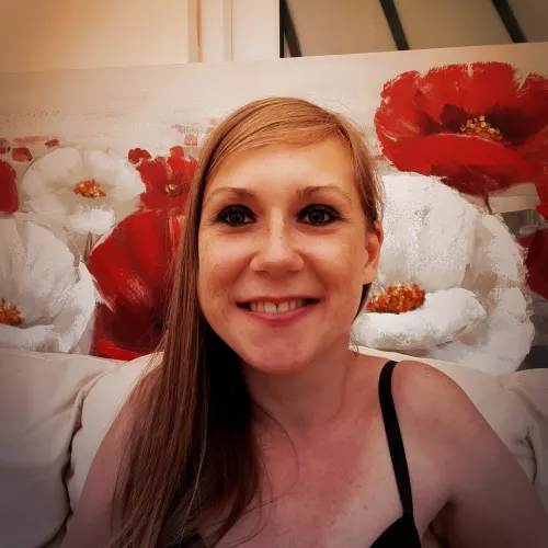 Yes, I have freckles. No, I don't hate them.