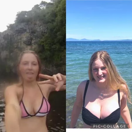 3 year boob transformation